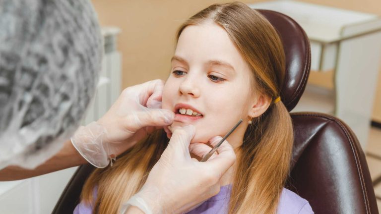 É possível corrigir “dentes de coelho” nas crianças? Saiba como o fazemos.